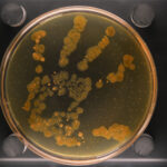 Petri dish with a colony of bacteria on a dirty hand