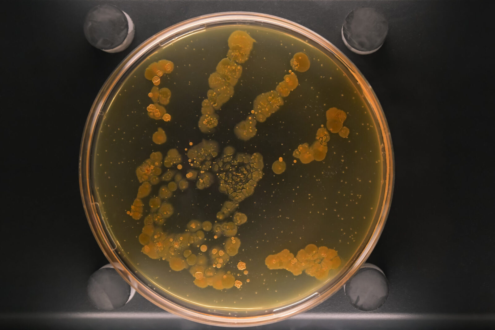 Petri dish with a colony of bacteria on a dirty hand